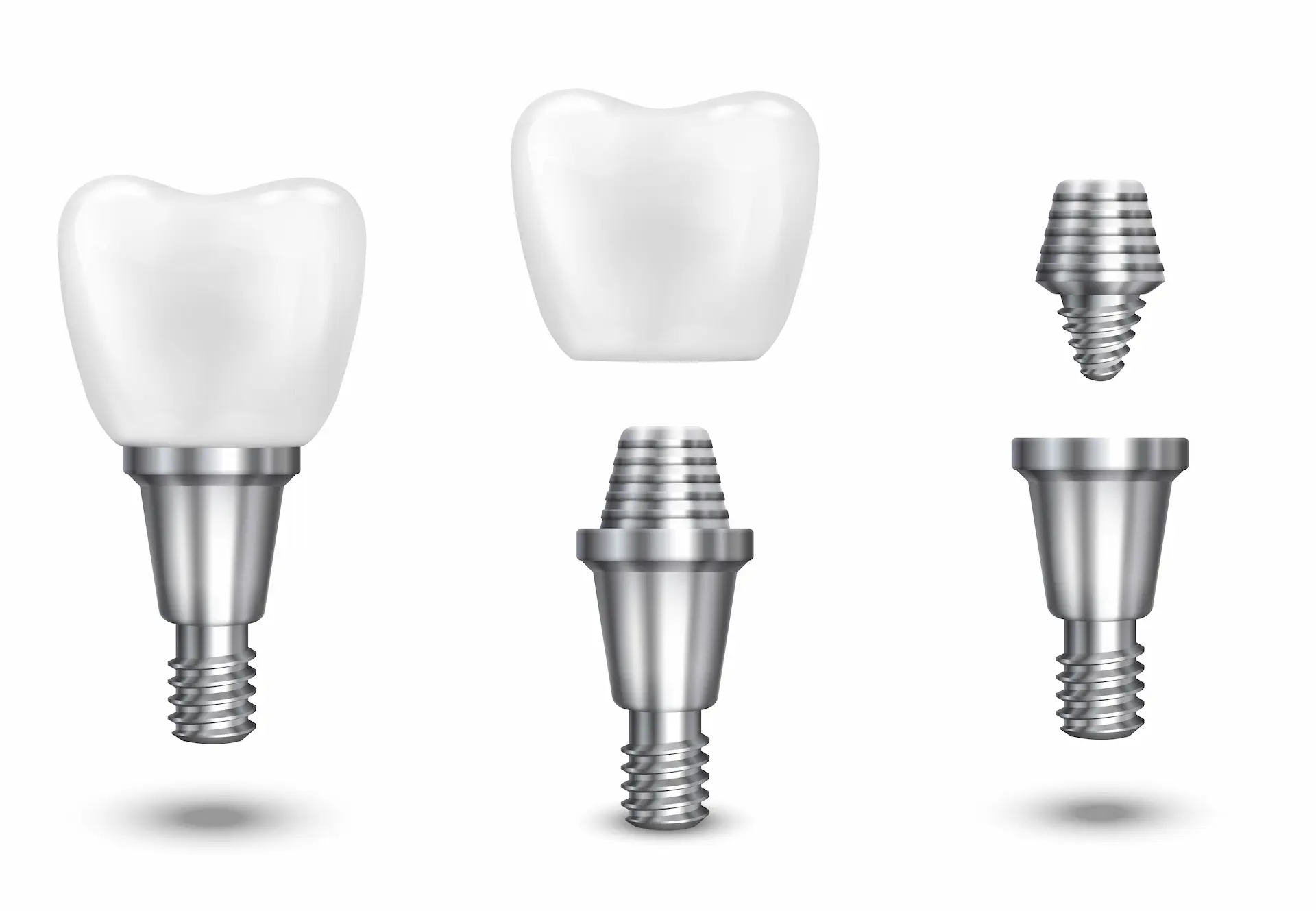 Gebze Diş İmplant Tedavisi, Kron ve Abutment