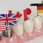 Diş implantı markaları ve üretim ülkeleri hakkında bilgilendirici görsel